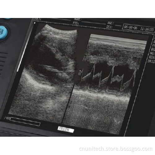 Vet Digital Ultrasound Scanner (UNT-3000V)